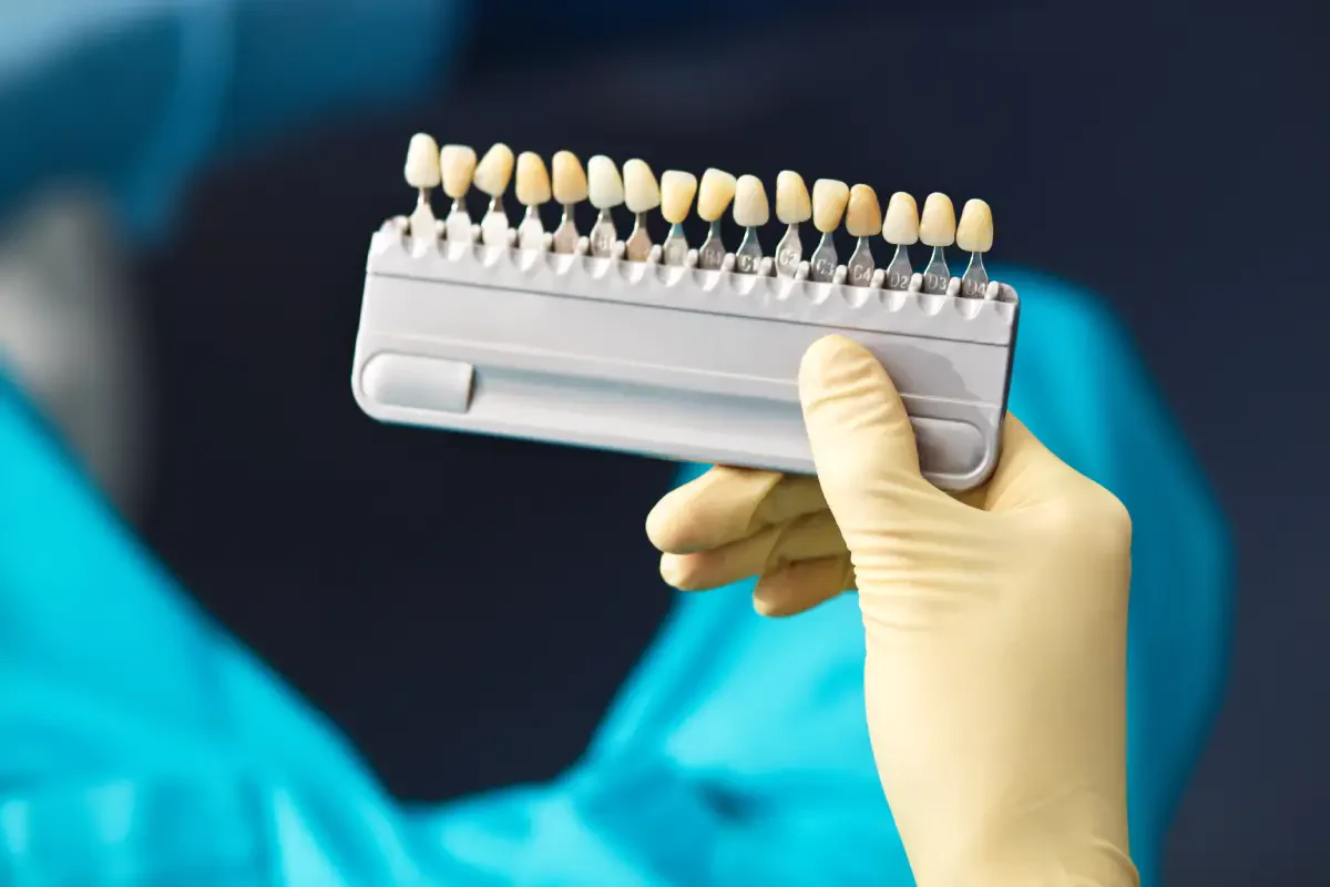 Dental veneers near me