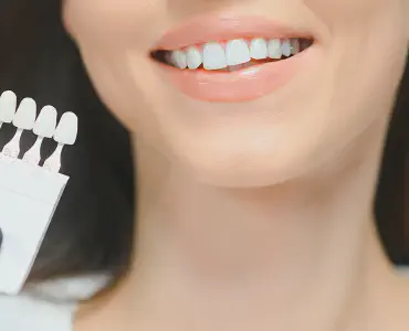Teeth Whitening Dalton GA | 6-8 Shades Brighter