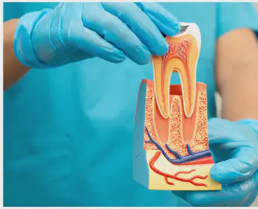 Root Canal Therapy Dalton GA | Painless Endodontic Treatment