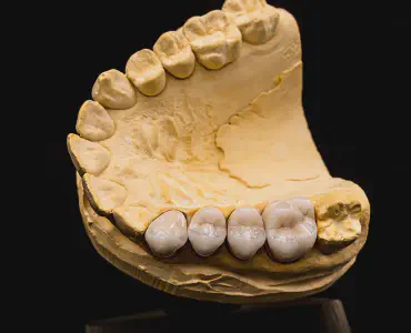 Dental Crowns & Bridges Dalton GA | Custom Porcelain Restorations
